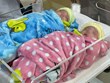 En Vietnam sobreviven dos gemelos prematuros con peso de sólo 500 gramos