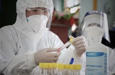 Vietnam confirma 64 nuevos contagios del COVID-19