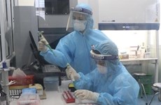 COVID-19: Vietnam reporta 47 nuevos casos del contagio local