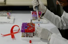 Más de mil vietnamitas reciben tratamiento de prevención de VIH