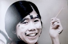 Documental sobre víctima vietnamita de dioxina gana en festival de cine en California