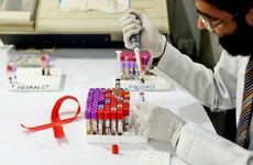 Vietnam se empeña en ampliar tratamiento antirretroviral para pacientes con VIH/SIDA