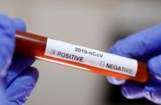 Aumentan a 49 casos infectados de coronavirus en Vietnam 
