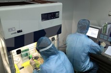 Vietnam puede dominar dos métodos de prueba del virus SARS-CoV-2