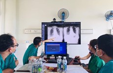 Vietnam recibe software de inteligencia artificial para tratamiento del COVID-19