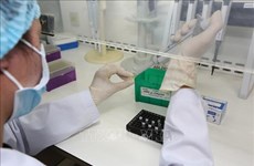 Empresa vietnamita dona 10 mil kits de prueba del COVID-19 al Ministerio de Salud