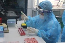 Vietnam reporta dos muertes por COVID-19 con enfermedades subyacentes graves