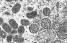 Vietnam aún sin registrar casos de viruela símica