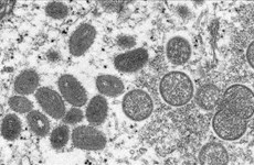 Vietnam se empeña en prevenir propagación de viruela símica