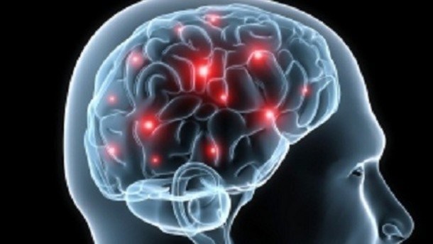 Demencia cerebro-vascular, enfermedad mas frecuente en Asia hinh anh 1