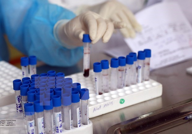 Garantizan capacidad de Vietnam de satisfacer exigencia de pruebas de coronavirus hinh anh 1