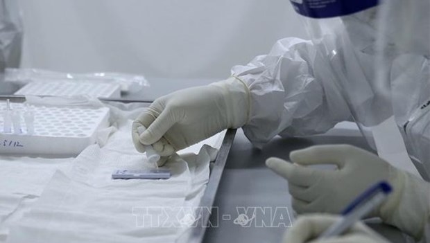 COVID-19: Vietnam amanece con 159 nuevos infectados hinh anh 1