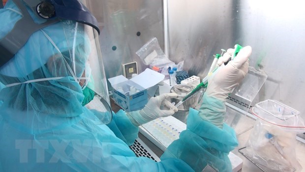 Ministerio de Salud insta a monitorear de cerca la situacion pandemica de la COVID-19 hinh anh 1