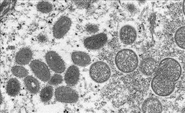 Vietnam detecta primer caso de viruela simica hinh anh 1