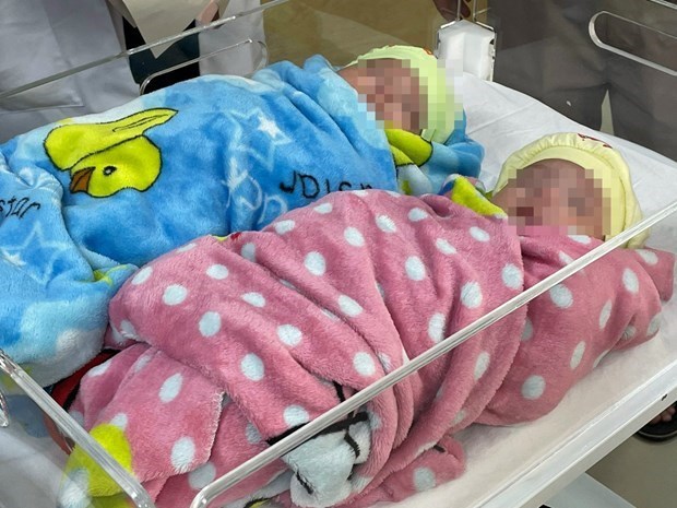 En Vietnam sobreviven dos gemelos prematuros con peso de solo 500 gramos hinh anh 1